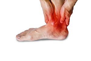 Early stages of Ankle arthritis, University Foot and Ankle Institute