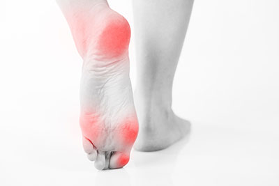 Bursitis Foot, University Foot and Ankle Institute