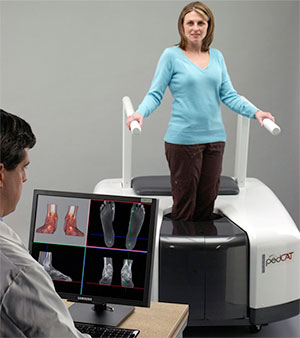 pedCat 3D CT Scanner at University Foot and Ankle Institute