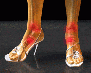 High Heel and foot pain