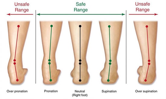 heel pain after walking