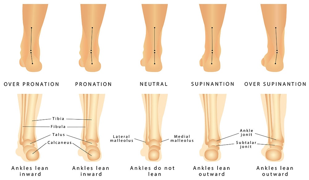over pronation and supination scale