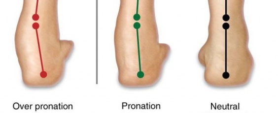 Overpronation: What Is It and How Can You Correct It?