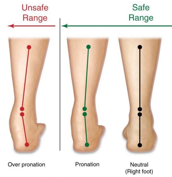 overpronation running