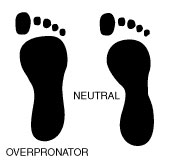 Wet feet test and overpronation, University Foot and Ankle Institute
