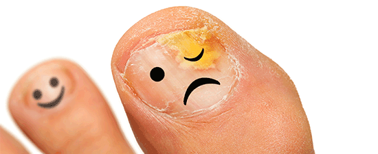 What To Do When Your Toenail Is Falling Off