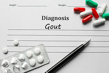 Diagnosing Gout 