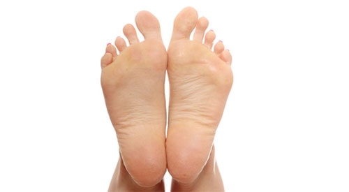 Bunions vs. Big Toe Arthritis, What’s the Difference?