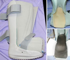 Charcot foot treatment