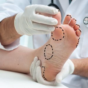 cosmetic foot surgery
