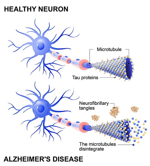 Diagram of brain neurons