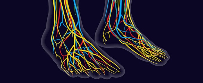 diabetic nerve damage, University Foot and ankle Institute