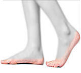 Adult Acquired Flatfoot (flexible flat foot)