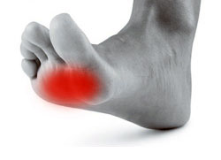 Ball of foot pain, University Foot and Ankle Institute