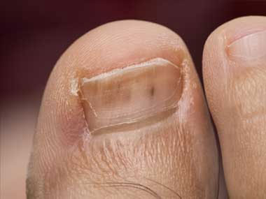 10 Diseases Your Feet Can Reveal | Microsoft News