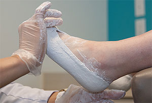 Custom Orthotics Los Angeles, University Foot and Ankle Institute